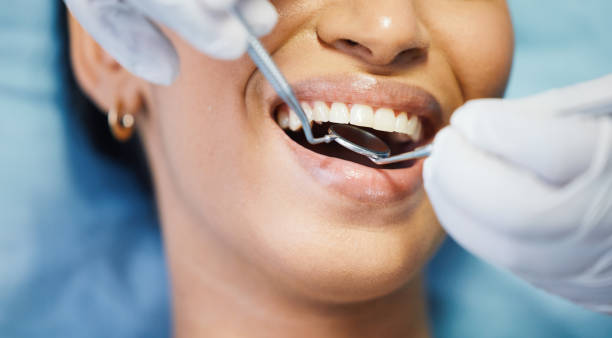 Best Emergency Wisdom Tooth Extraction in New Berlin, IL
