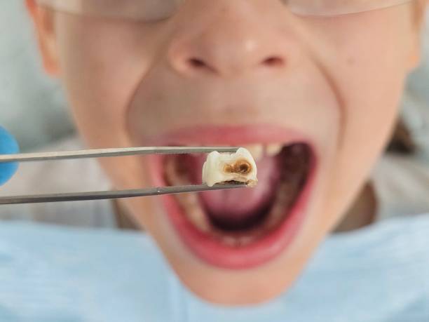 Best Emergency Care for Gum Disease in New Berlin, IL